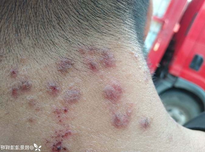 【天等：桂西南喀斯特屏障下的低感染样本_70112】