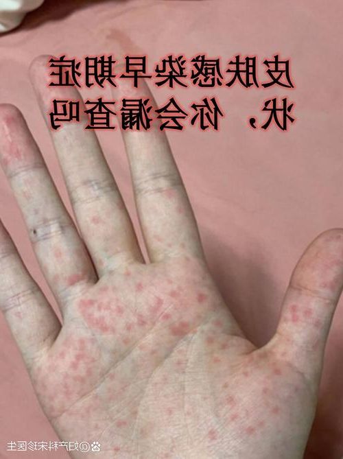 2022年10月27日喀什新增无症状感染者情况_22958