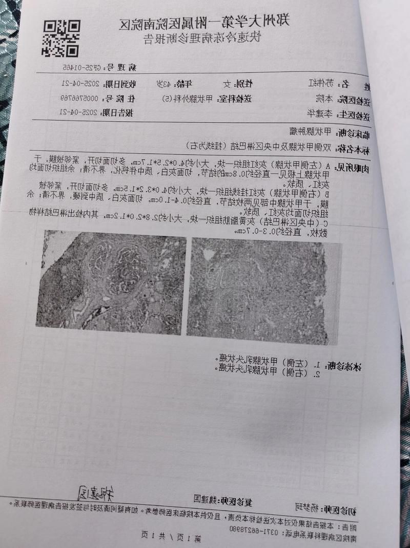 2022年3月15日同江新增确诊病例情况_61453