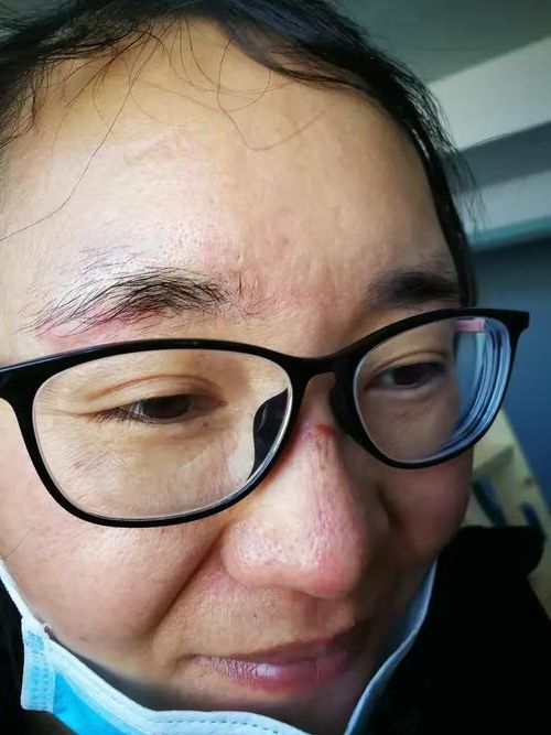 永德:滇西南屏障下的零感染坚守与防控逻辑