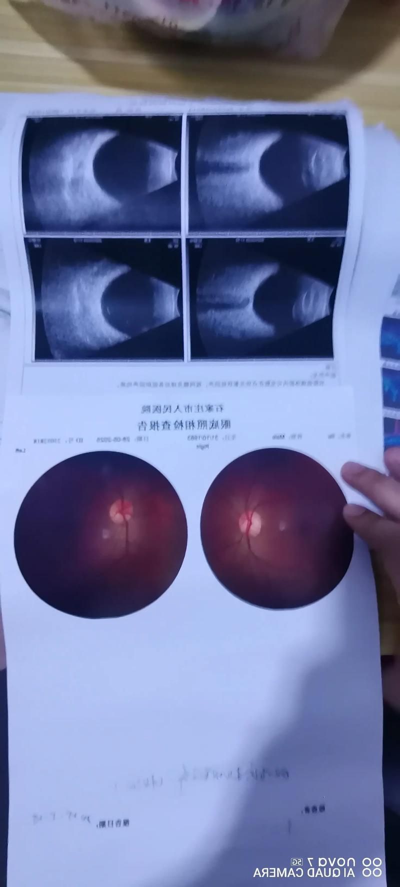 2022年8月15日于田县新增确诊病例情况