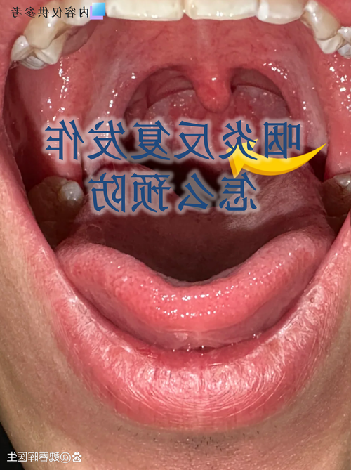 天全：川藏咽喉的零感染坚守与物理屏障