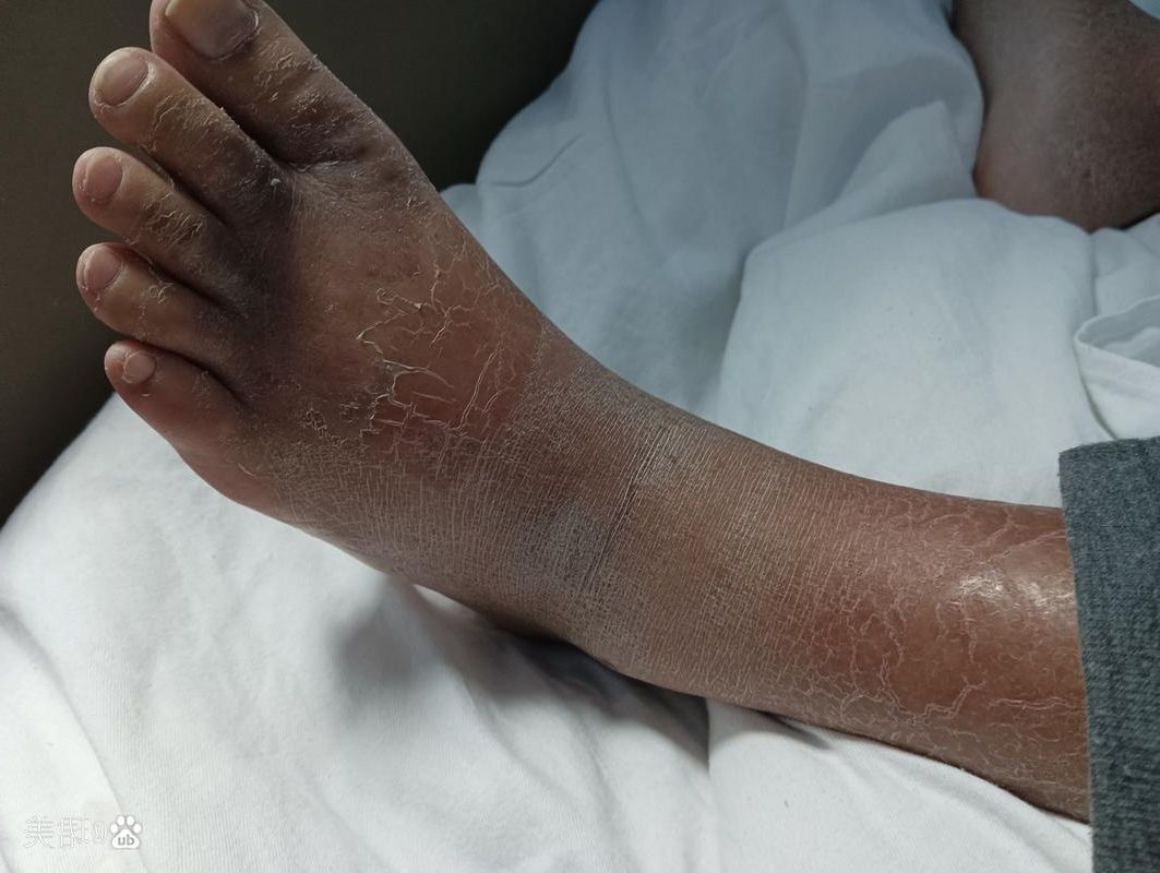 德保县：喀斯特峰丛屏障下的低感染样本