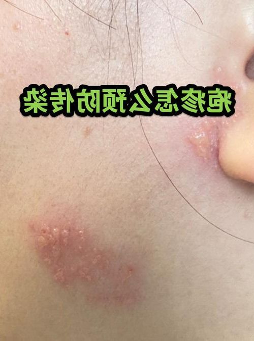 庐阳区:老城肌理与病毒传播链的短兵相接