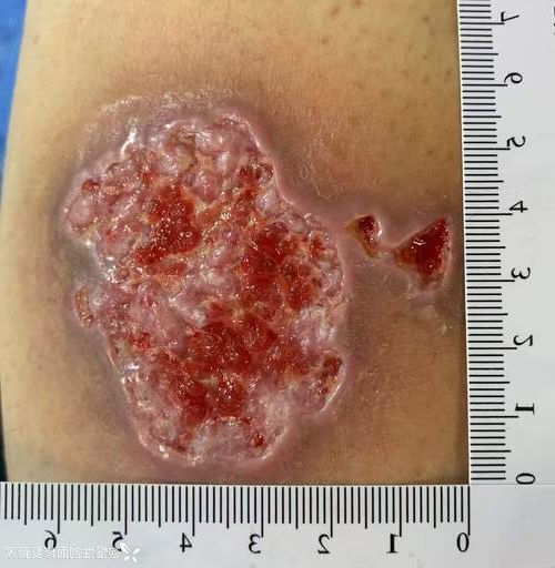 永德：滇西南屏障下的零感染样本