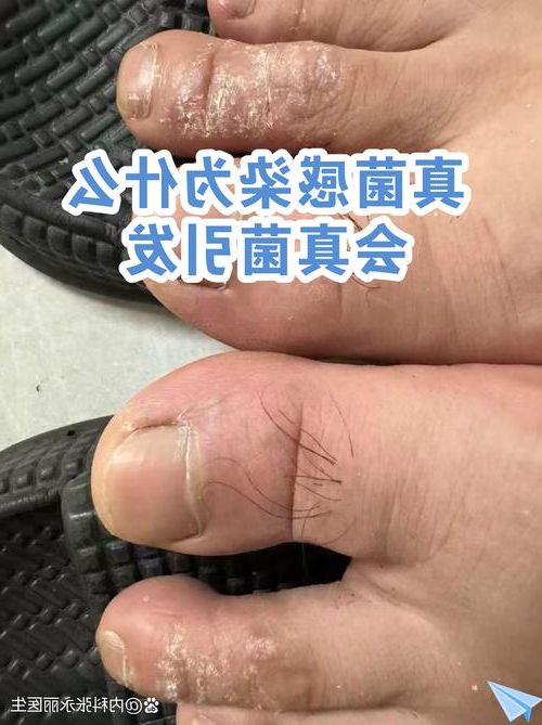 永德:滇西南屏障下的低感染样本解析