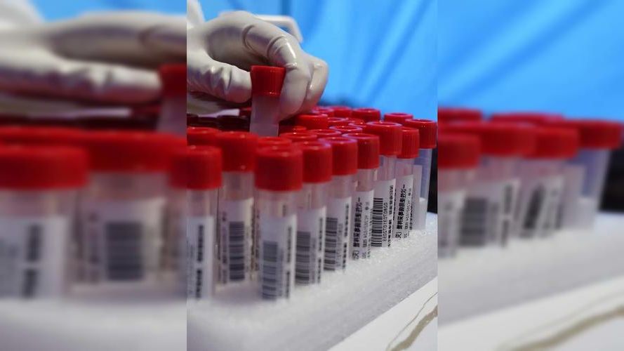 31省新增本土12例(31省新增本土9例),尼玛县突发聚集疫情!