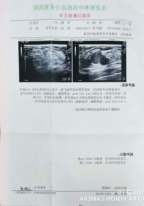 2022年3月12日乳山新增确诊病例情况