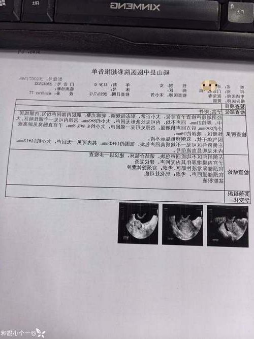 2022年11月25日灵台县新增确诊病例情况