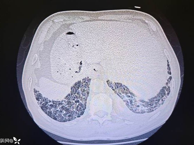 云和县：浙南山地屏障下的低感染样本