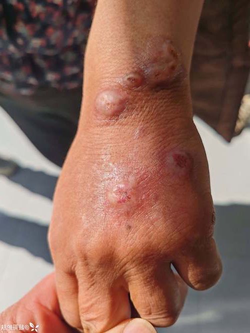 永春县：戴云山屏障下的低感染样本